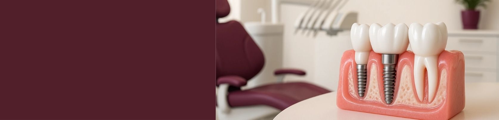 dental implants main image