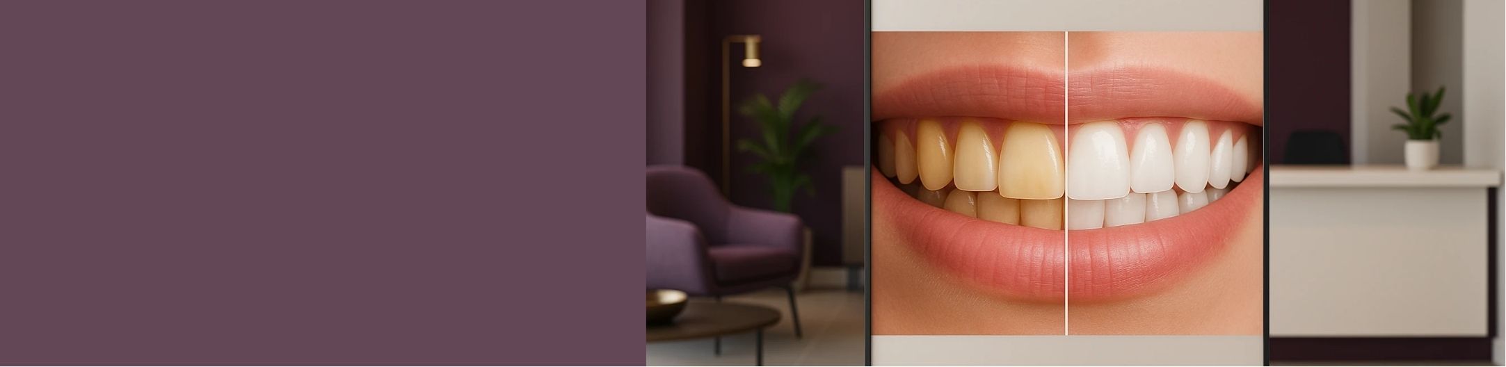 image gallery banner