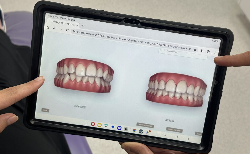 invisalign consultation bristol