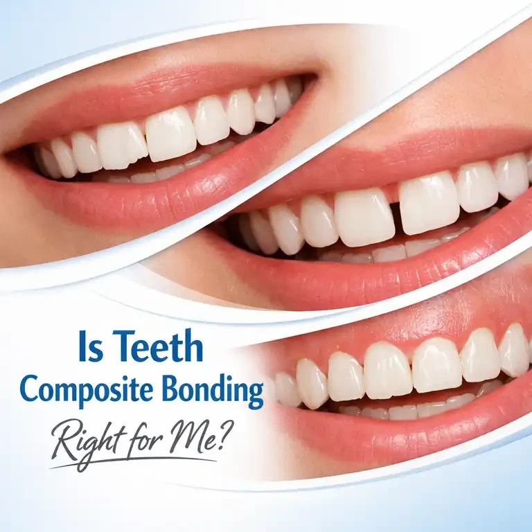 is composit bonding right for me- bristol practice