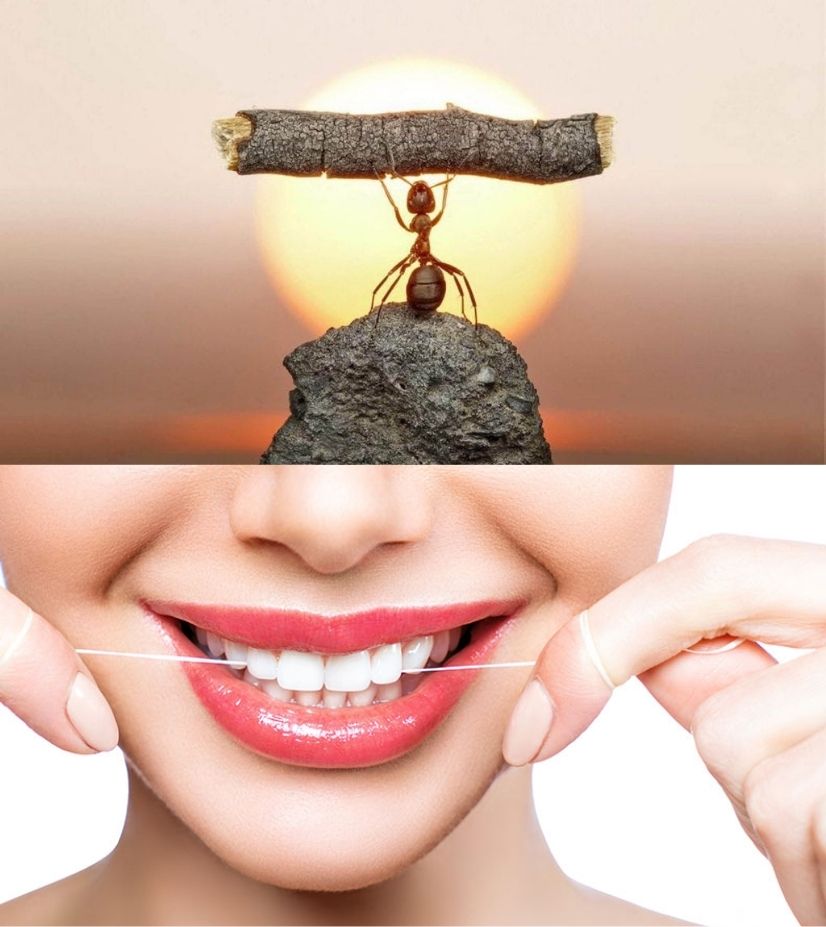 desipline and oral hygiene for invisalign