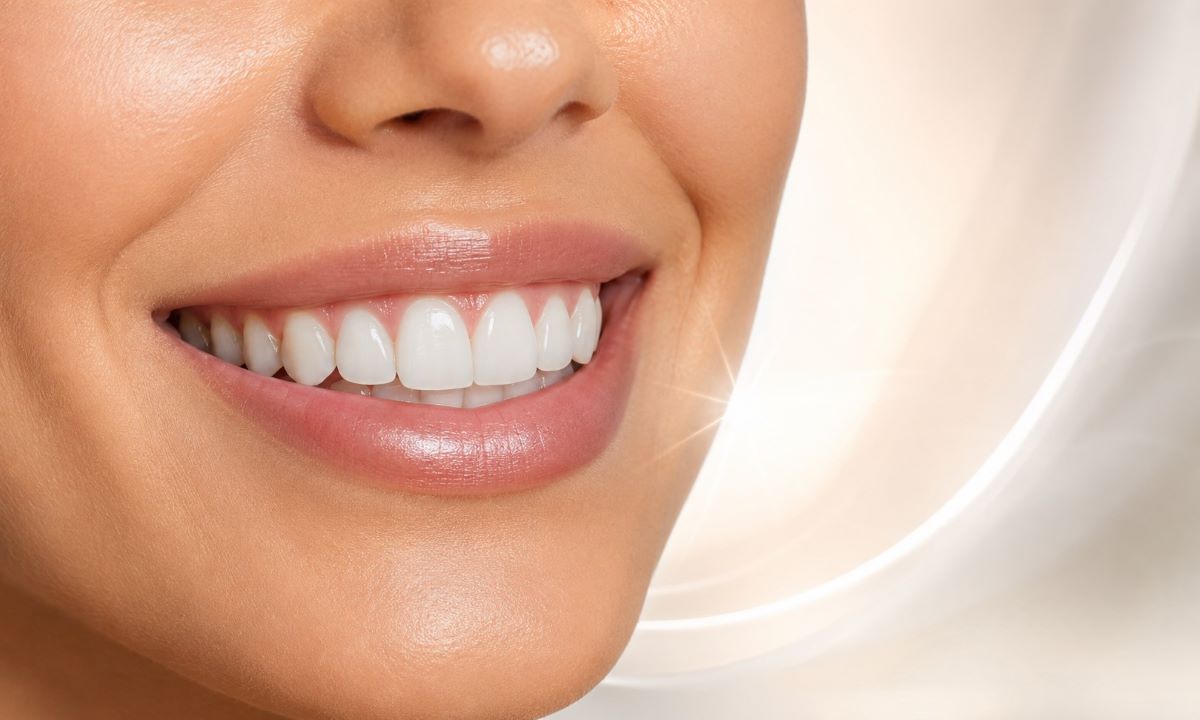 Composite bonding treatment at Lodge Causeway Dental Centre in Bristol