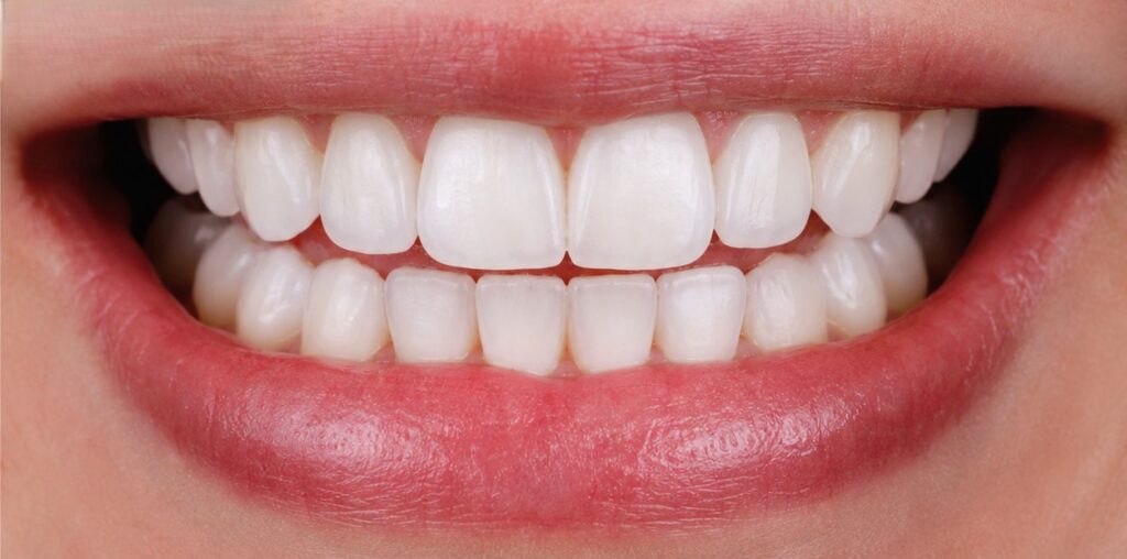 After treatment image