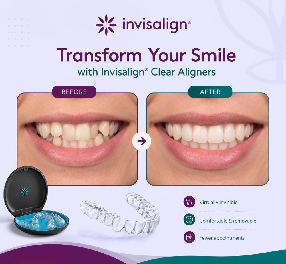 Invisalign before-and-after smile transformation with clear aligners